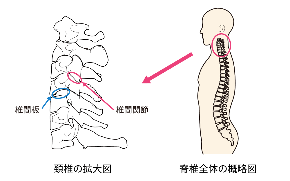 図４．頚椎の外観